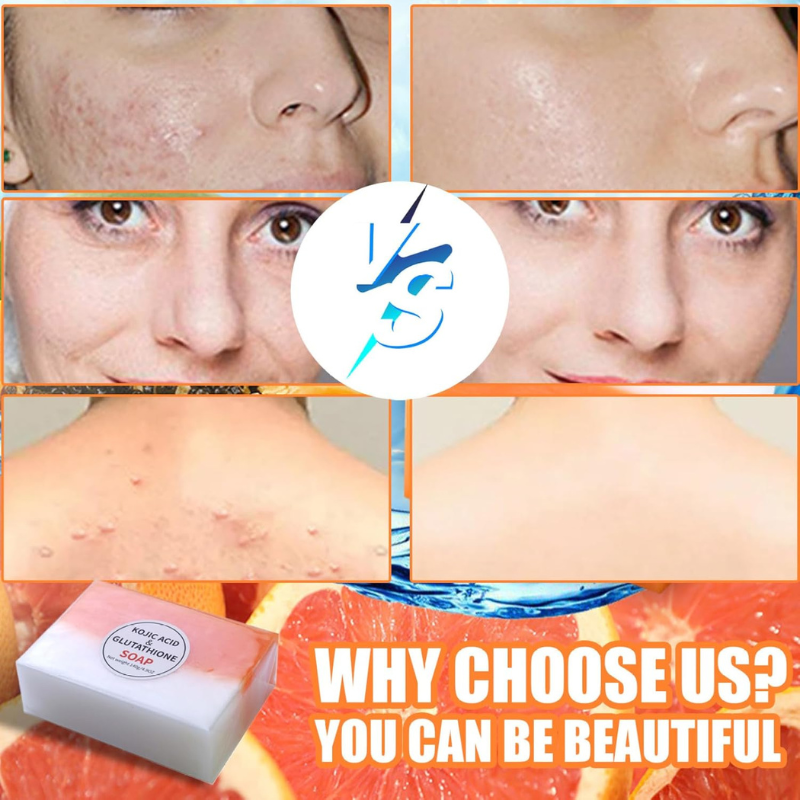 Glutathione Soap 2Pcs Skin Whitening Rich Foaming 140g Kojic Soap Natural Organic Multi-usage for Face Back Legs Body