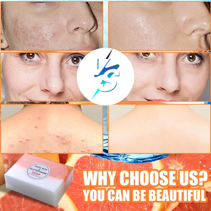 Glutathione Soap 2Pcs Skin Whitening Rich Foaming 140g Kojic Soap Natural Organic Multi-usage for Face Back Legs Body